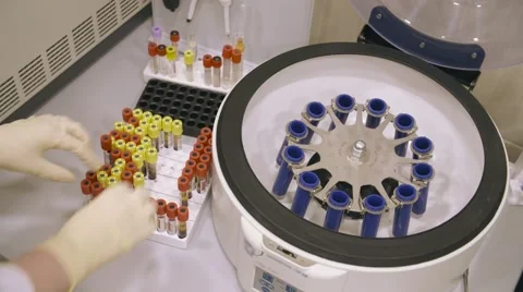 Unrecognizable nurse putting blood samples in machine Stock Footage 62296162