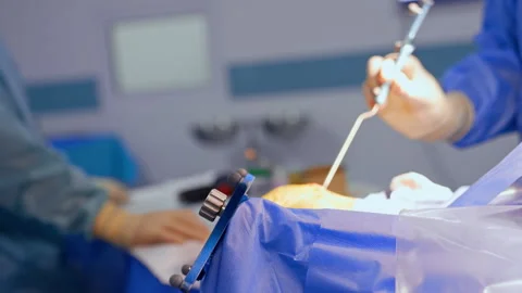Unrecognized medics apply neurosurgical tools in the operating room. Modern Stock Footage 340928746