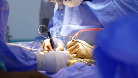 Unrecognized surgeon's hands in latex gloves apply electric tool at operation. Stock Footage 288363589