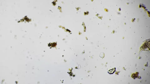 Unseen microscopic rotifer actively moving among algae fragments and debris in Stock Footage 344085921
