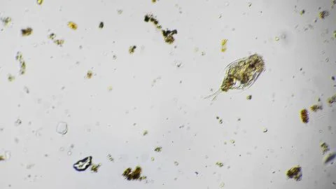 Unseen microscopic rotifer actively moving among algae fragments and debris in Stock-Fotos
