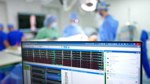 Upper part of the computer screen working during neurosurgery. Colorful lines Stockbeeldmateriaal 325225145