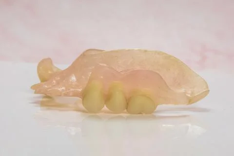 Upper Partial Denture on White Background Removable Dental Prosthesis Stock Photos