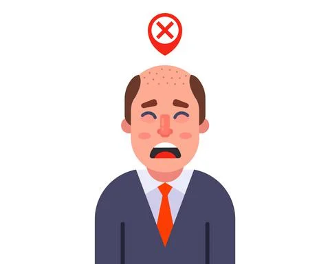 Upset man with bald head. worry about hair loss. Stock Illustration