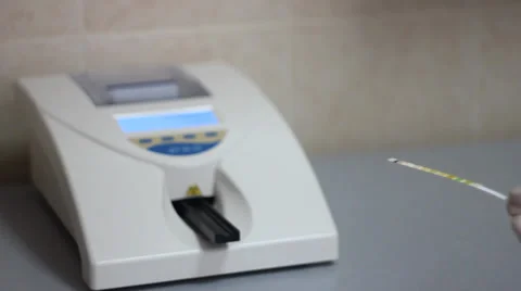 Urinalysis: a study of the sample and obtaining test results Stock Footage 39740987