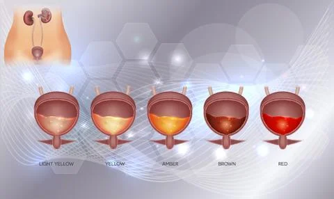 Urinary bladder and various urine colors Illustrazione stock