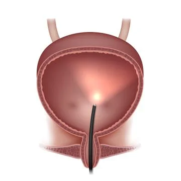 Urinary bladder examination Stock Illustration