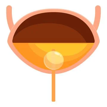 Urinary bladder storing urine with prostate gland showing benign prostatic Illustrazione stock