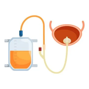 Urinary catheter draining urine into collection bag from bladder, medical device Stock Illustration