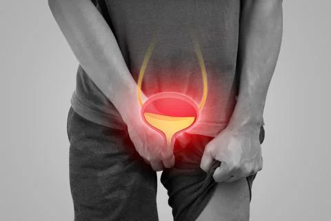 Urinary hesitancy symptoms. Stock Photos