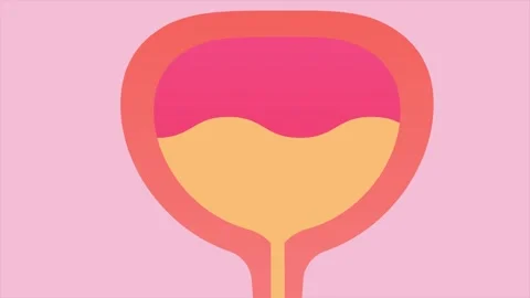 Urinary incontinence. Abstract loop animation Stock Footage 304822329