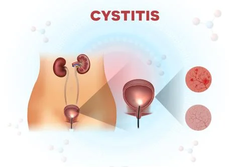 Urinary system anatomy and urinary bladder examination Stock Illustration