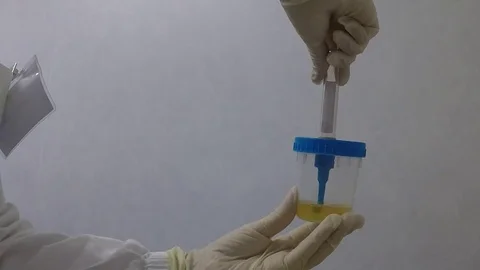 Urine analysis in laboratory analysis 動画素材 76580446