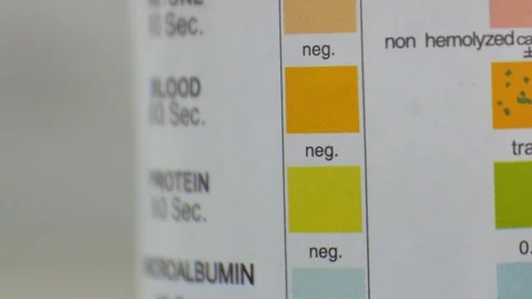 Urine analysis in laboratory colour level chemical in urine. Stock Footage 108249433