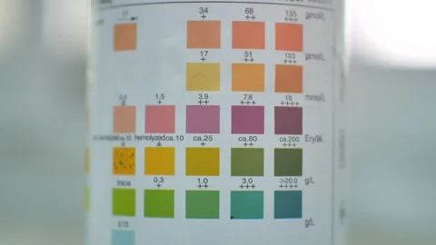 Urine analysis in laboratory colour level chemical in urine. Video stock 108249435