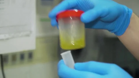 Urine analysis in the laboratory. Stockbeeldmateriaal 83395306