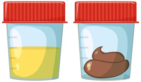 Urine and Stool Samples in Medical Collection Containers Stock Illustration