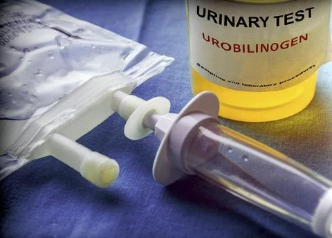 Urine collection container for urobilinogen analysis in a laboratory, conce.. Stock Photos