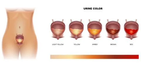 Urine color Stock Illustration