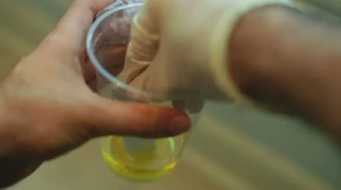 Urine drug testing urinate Stock Footage