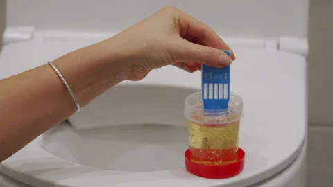 Urine rapid drug test detects whether someone has recently used drugs. Stock Footage 295274487