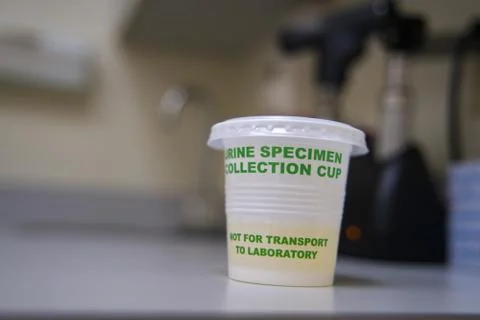 Urine sample collection cup partially filled on examination room table ready  Stock Photos