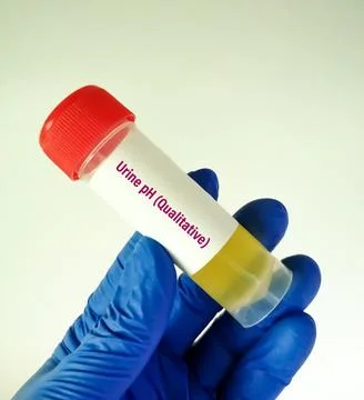 Urine sample container with sample for Urine pH (Qualitative) test. 스톡 사진
