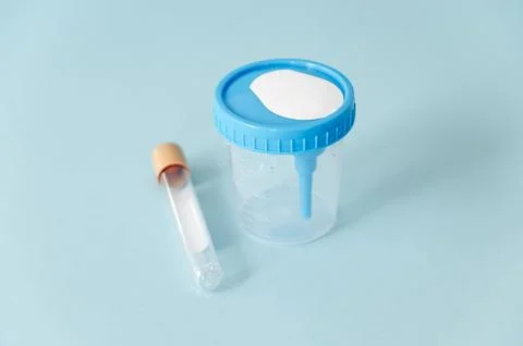 Urine sample jar and vacuum tube on blue background Stock Photos