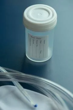 Urine sample Stock Photos