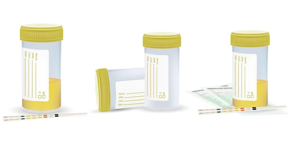 Urine sample set, full and empty containers. Vector illustration Stock Illustration