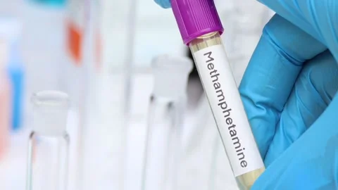 Urine samples for testing Methamphetamine in the laboratory Stock Footage 219401244