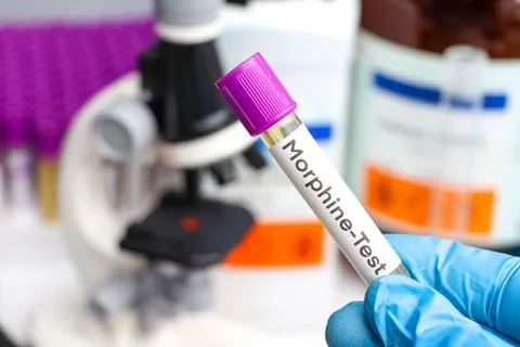 Urine samples for testing Morphine in the laboratory Stockfoto's