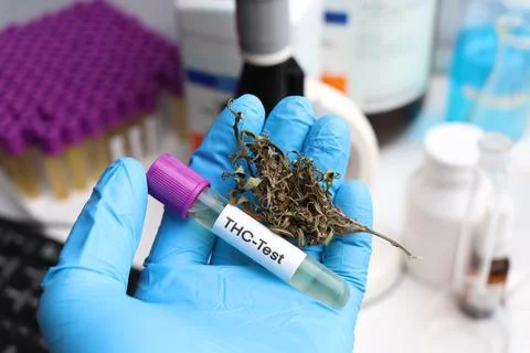 Urine samples for testing THC in the laboratory, urine Stock Photos