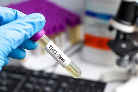 Urine samples for testing THC in the laboratory, urine Stockfoto's