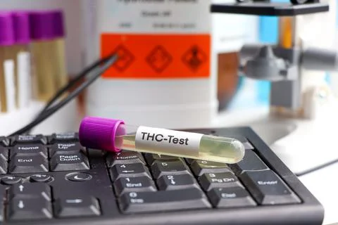 Urine samples for testing THC in the laboratory, urine 스톡 사진