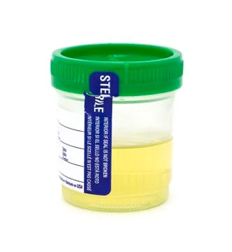 Urine specimen cup Stock Photos