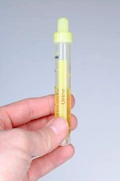 Urine specimen Stock Photos