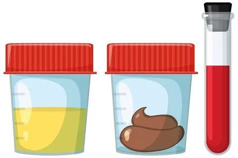 Urine, Stool, and Blood Sample Containers Illustration 库存插图