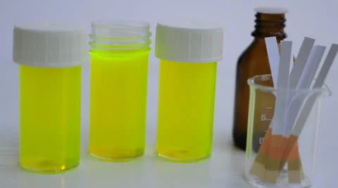 Urine test Stock Footage 22558291