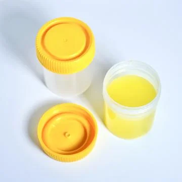Urine test jar containers Stock Photos