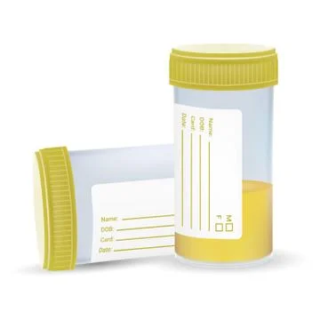 Urine Test In A Plastic Jar Isolated On A White Background. Realistic Vector Stock Illustration