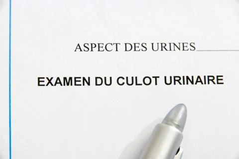 Urine test result Stock Photos