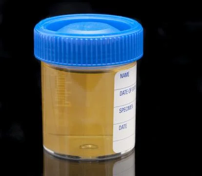 Urine test specimen Stock Photos
