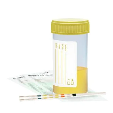 Urine Test Strip With The Plastic Jar Of Urine And Blanks. Medical Examination Stock Illustration