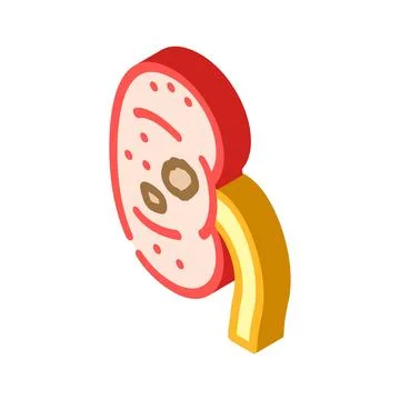 Urolithiasis urology isometric icon vector illustration 库存插图