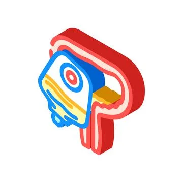Urostomy urology isometric icon vector illustration Stock Illustration