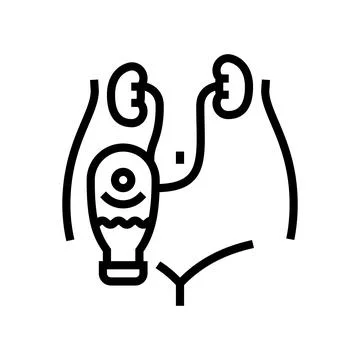 Urostomy urology line icon vector illustration 스톡 일러스트