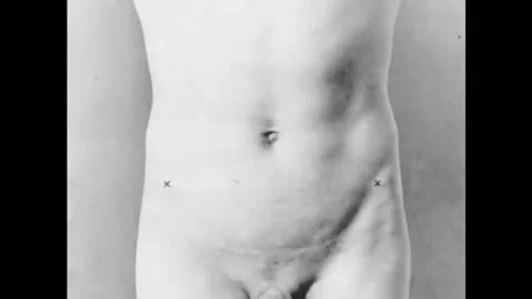 USA - 1929 - The location of the appendix in the human body is pointed out. Stock Footage 259630709