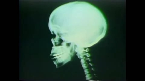 USA - 1974 - The scanning electron microscope was invented so scientists could Stock Footage 296410778