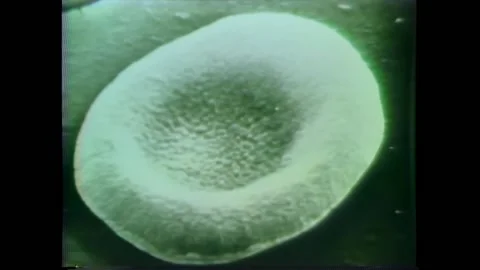 USA - 1974 - Scientists use a scanning electron microscope to study red blood Stock Footage 296383875